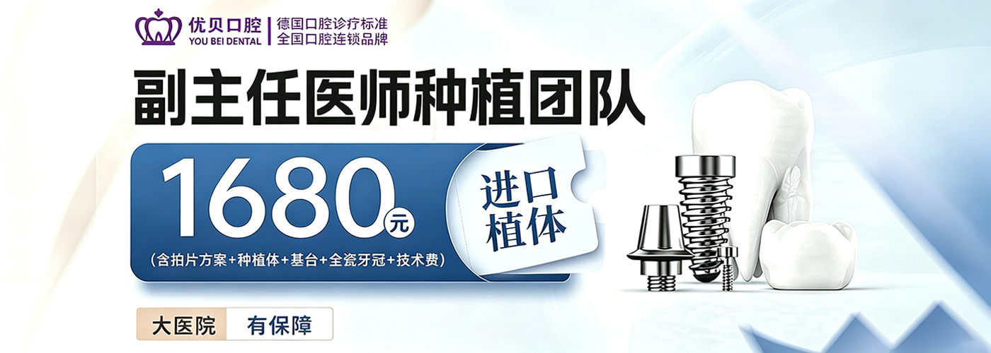  进口种植牙1680元